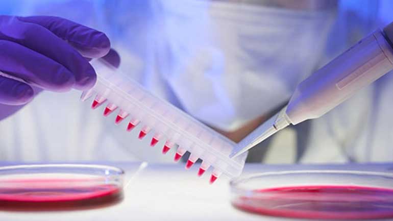 Νέο τεστ αποκαλύπτει όλες τις λοιμώξεις από ιούς σε μια μόνο σταγόνα αίματος Νέο τεστ αποκαλύπτει όλες τις λοιμώξεις από ιούς σε μια μόνο σταγόνα αίματος